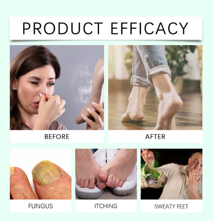 👣Tea Tree Oil Foot Spray - Plantar Moisturizing 👟Deodorant for Odor Control & Dry Feet Care