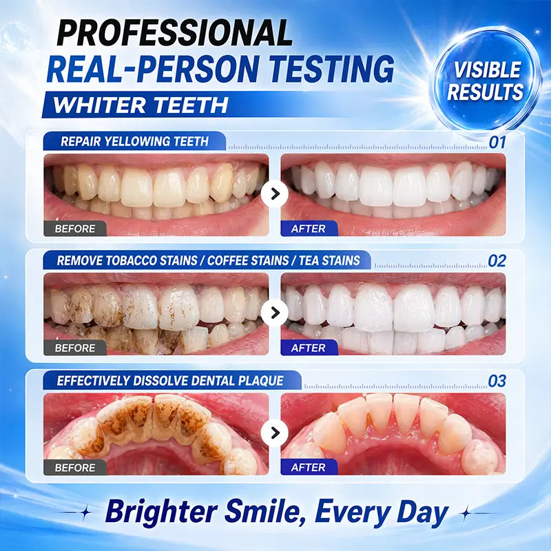 🦷✨Niacinamide Foaming🫧 Whitening Toothpaste 8X - Fresh Breath Stain Removal Gentle Teeth Cleaning