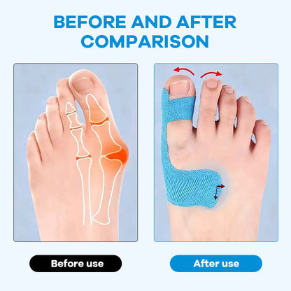Cut Bunion Corrector Kinesiology Tape– Elastic, Breathable & Hypoallergenic Latex-Free Toe Support Strips